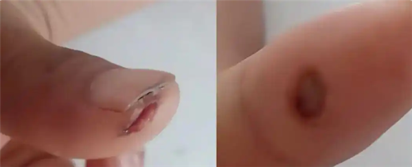 浙江一早餐店老板触电 妻子抄起油桶砸丈夫获网友好评